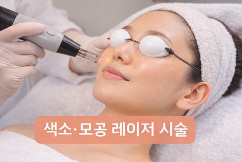 눈 보호 가리개를 착용한 여성이 얼굴에 색소 및 모공 개선 레이저 시술을 받는 장면