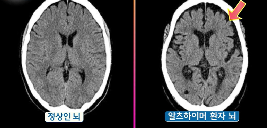 글루타치온 효능