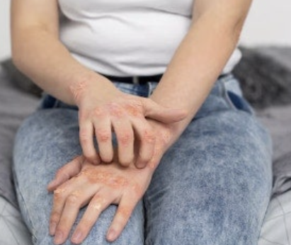 비타민d 효능 36