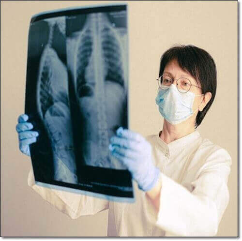 갈비뼈 실금 증상 및 진단, 갈비뼈 영상을 살펴보는 의사