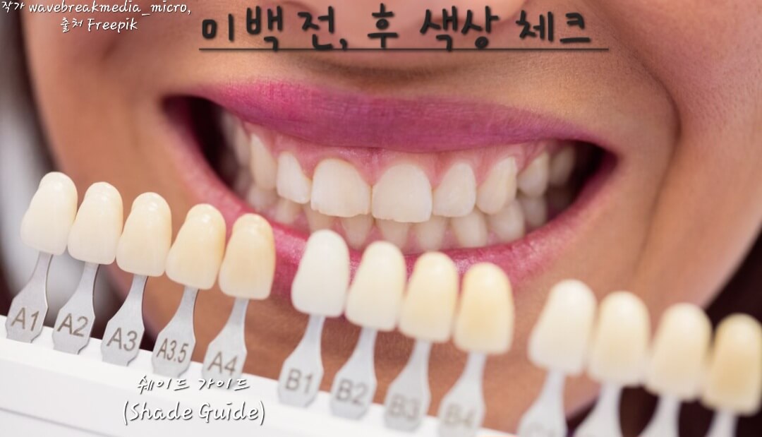 쉐이드 가이드
