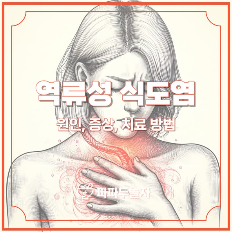 역류성 식도염 원인, 증상, 치료방법