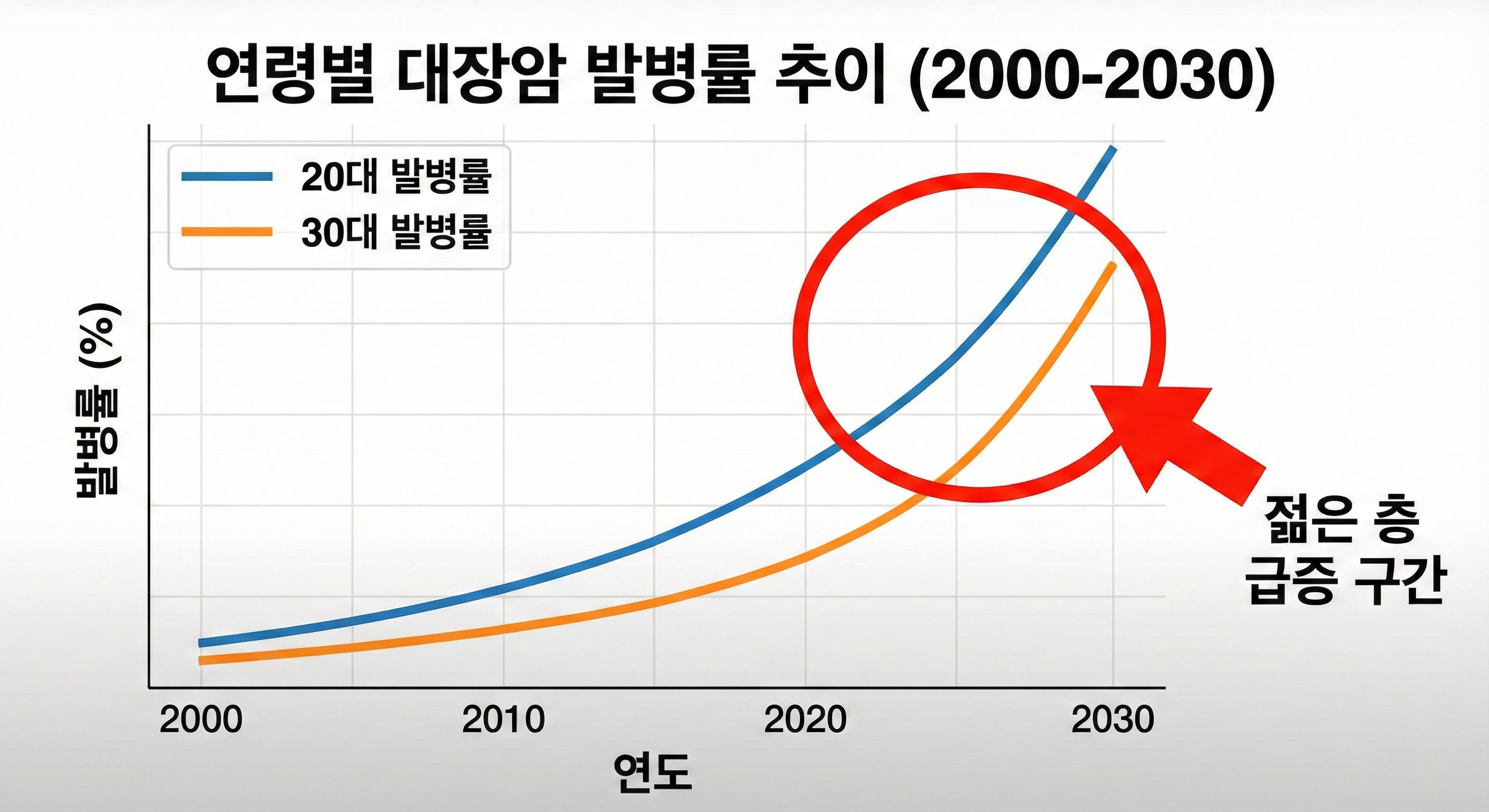 "설마 내가?" 2030 대장암 급증, 더 이상 남의 일이 아닌 이유