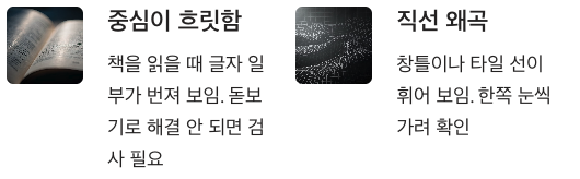 황반변성 초기 중심이 흐릿함, 직선 왜곡