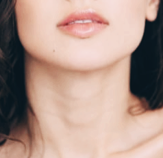 목젖이 부었을 때, 늘어진 느낌과 아플 때 원인과 치료법