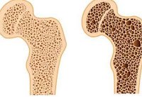 자가진단 테스트
