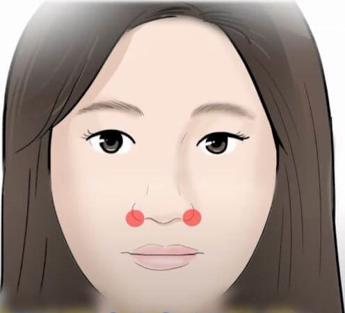영향혈 위치