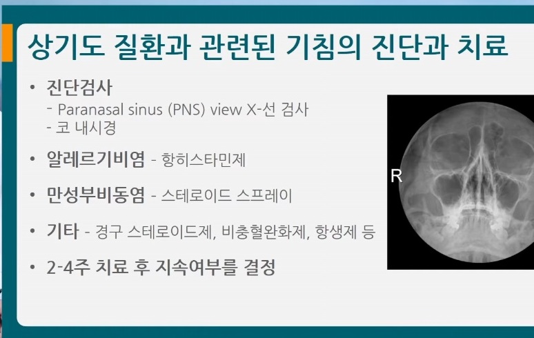 만성기침치료
