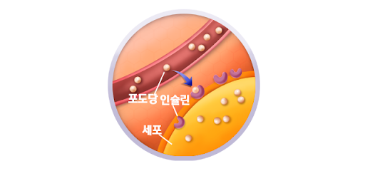 당뇨병 초기증상