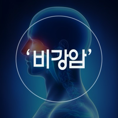 (비강암)