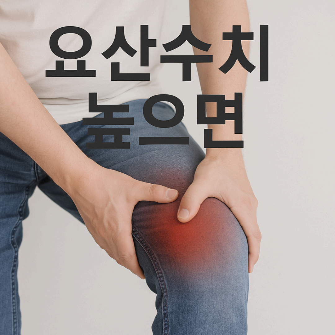 잦은 관절통, 요산수치 높으면 의심하세요