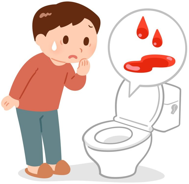 소변에서 피가 나오는 경우