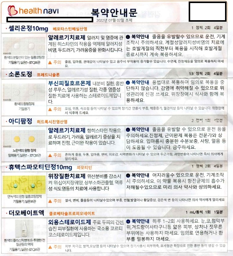 지루성 두피염 처방