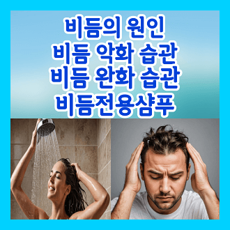 비듬이 원인과 비듬 악화 습관, 비듬 완화 습관 비듬 예방에 효과적인 성분