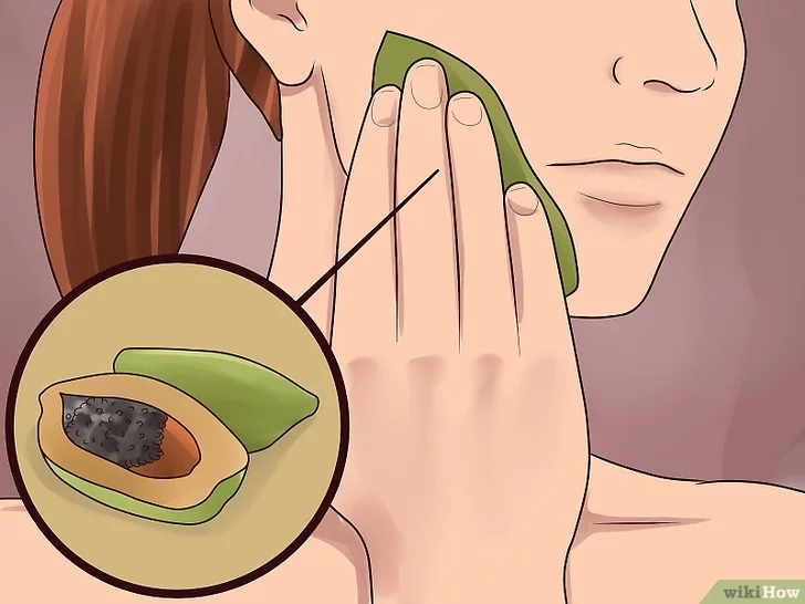 기미 잡티 제거