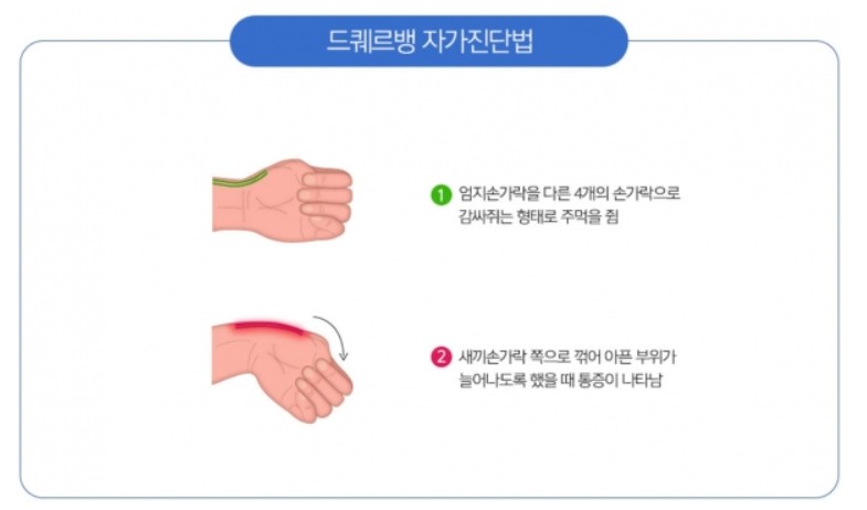드퀘르뱅 자가진단 방법