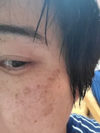 도미나크림 가격 정보 및 실제 사용후기와 효과 성분 정리_7