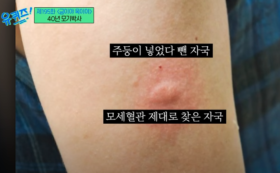 혈관을 찾을 때 까지 찌르는 모기