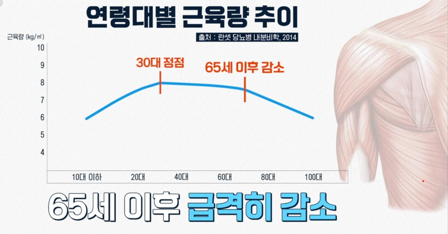 노인 근육 부족