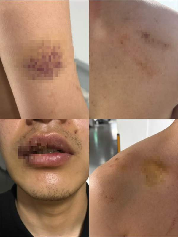 경산 친구 살해 24세 정재환 신상 공개: 피범벅 알몸 편의점 배회와 경찰 25초 방치 논란 핵심 정리