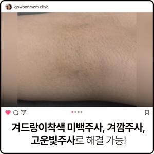 팔꿈치 착색