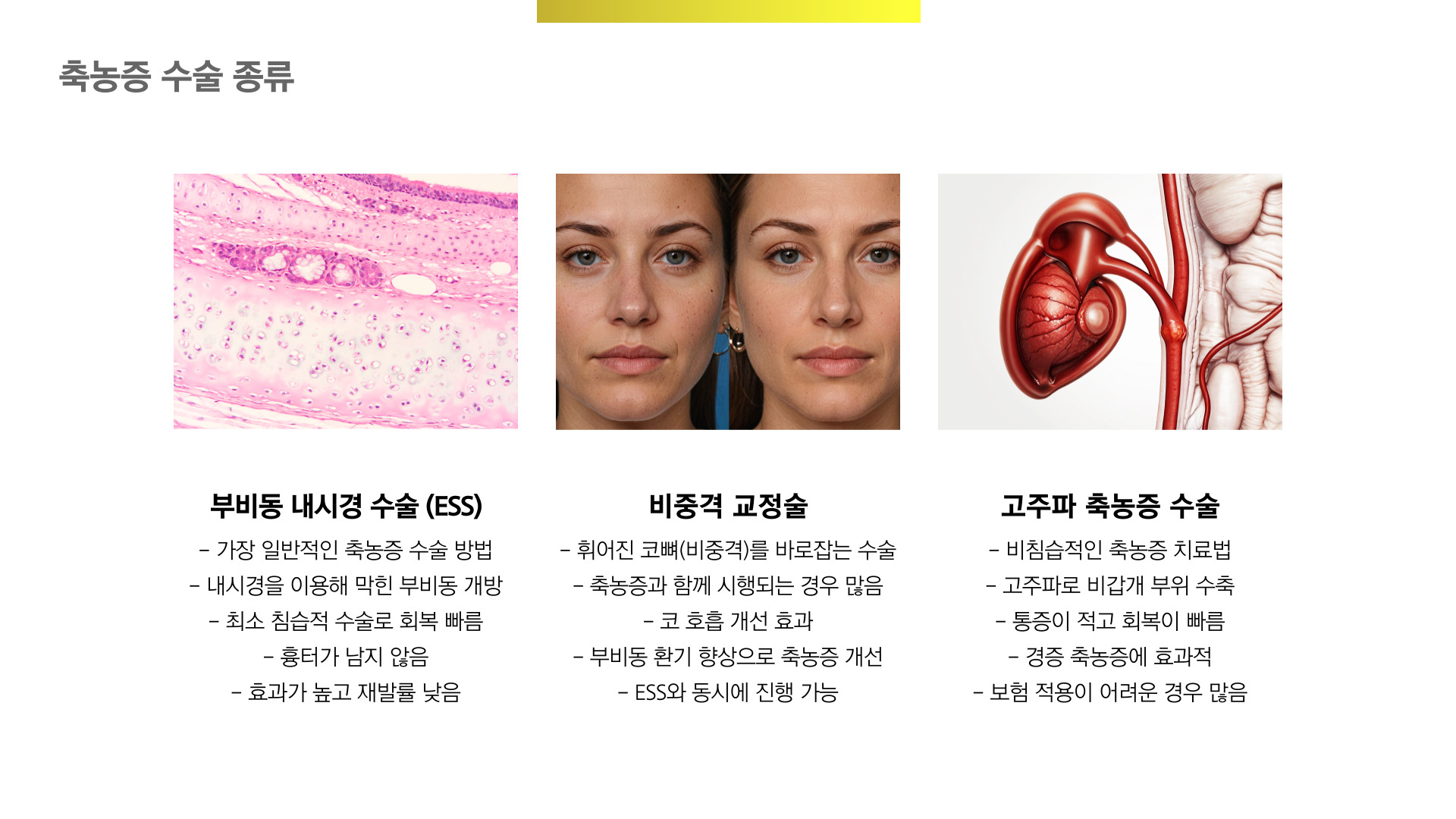 축농증 수술 비용