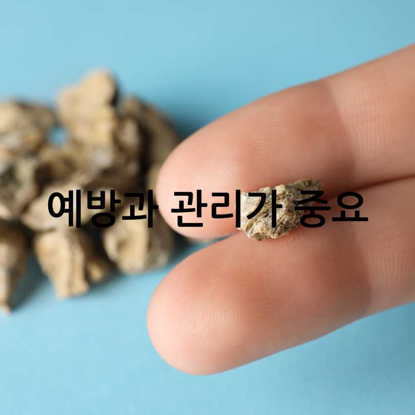 요로결석 증상과 피해야 하는 음식