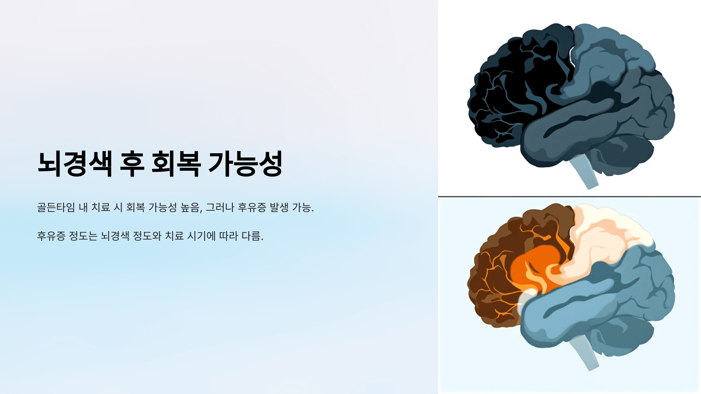 뇌경색과 관련된 사진입니다.