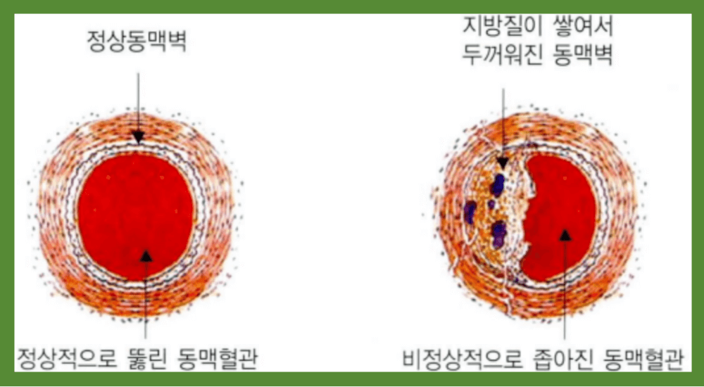 혈관