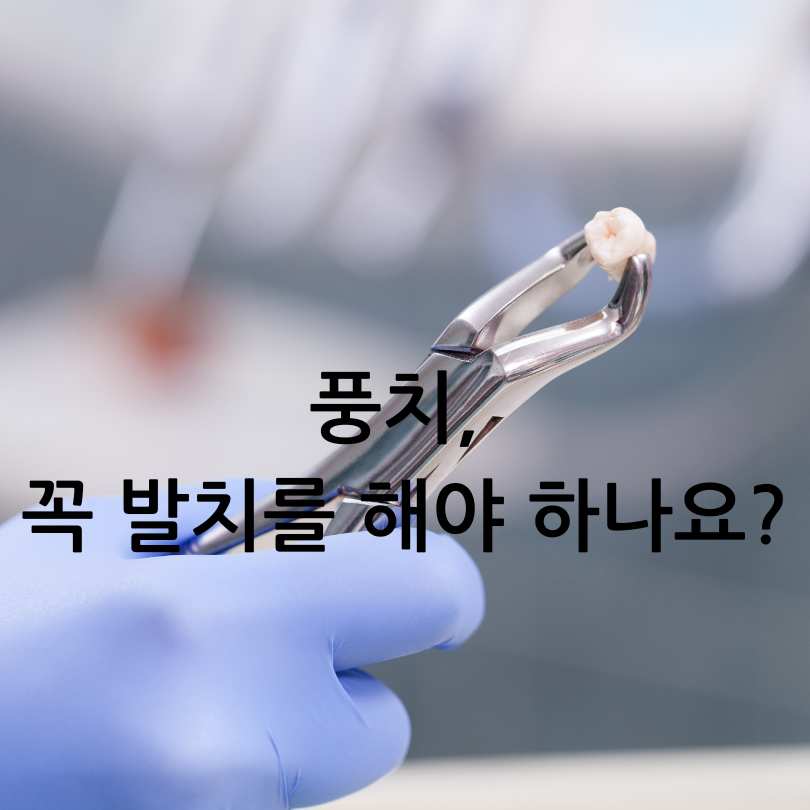 풍치 원인, 증상, 치료법부터 발치