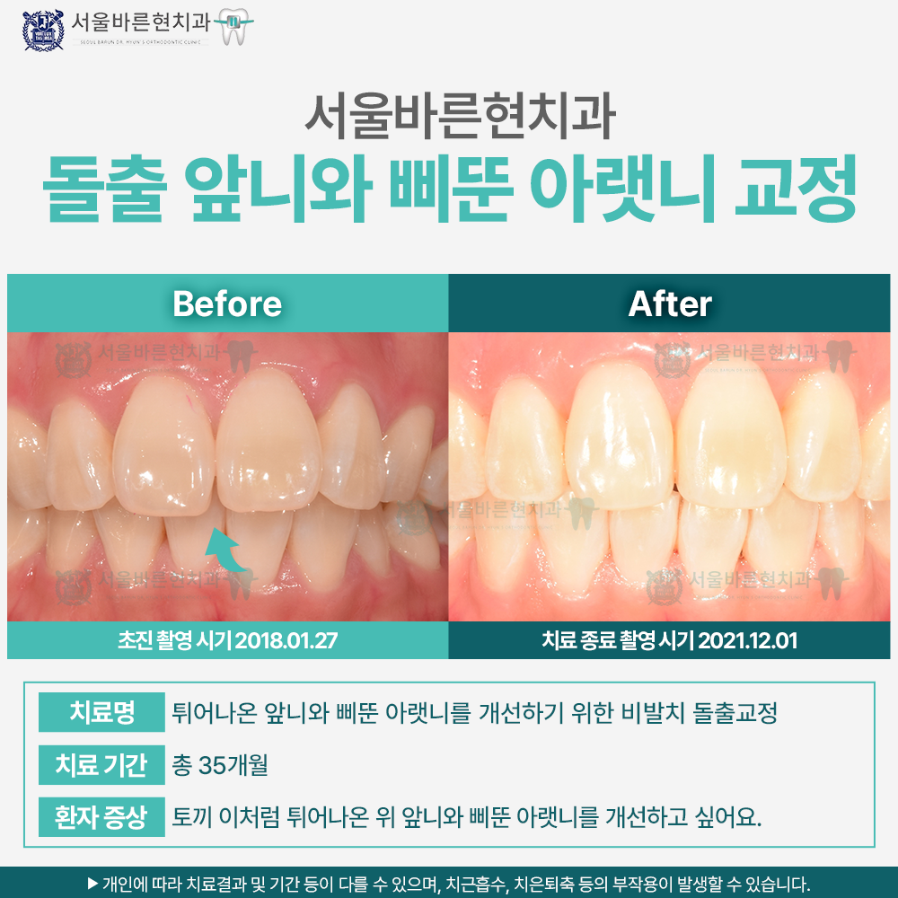 해운대교정치과