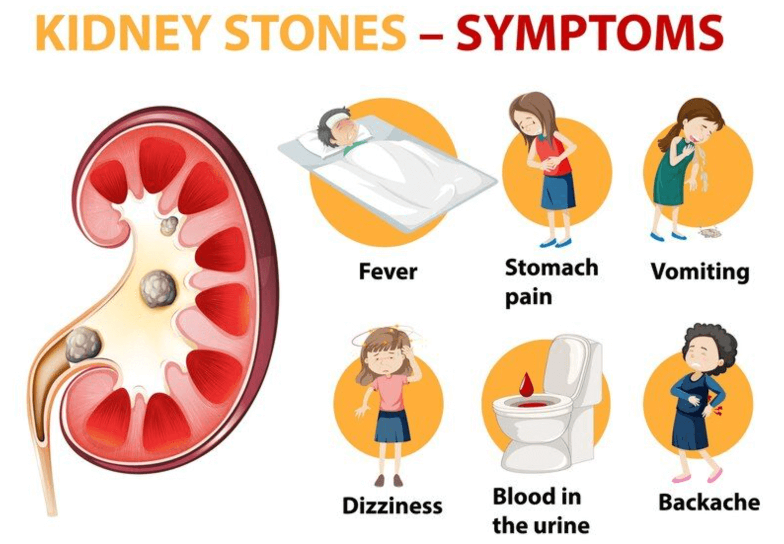 여자 옆구리 통증