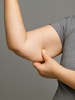 여름 대비 팔뚝 다이어트