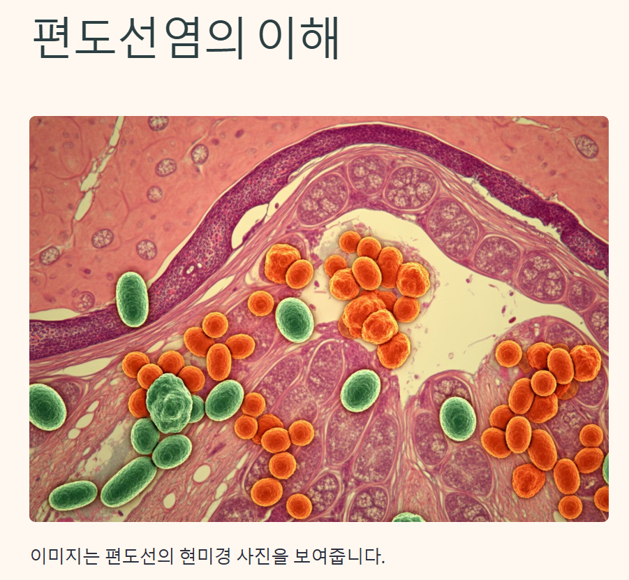 편도선염