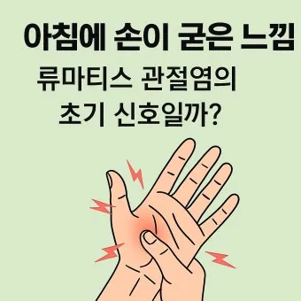 효과적인 류마티스 관절염 치료제 추천 약물 비교 가이드 2025 최신판_9