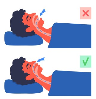 코골이 하는 이유