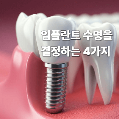 임플란트 수명을 결정하는 4가지