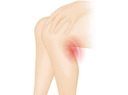 오금이 아픈 이유