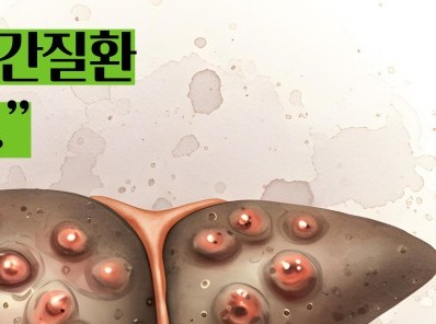 간경화 초기증상