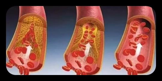 콜레스테롤 이미지