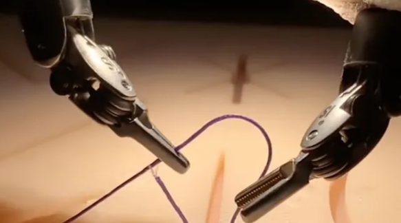 ai surgery
