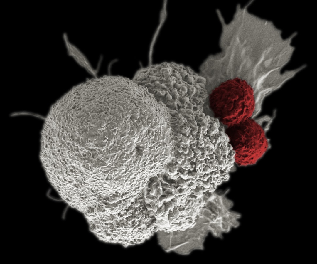 Bile duct cancer
