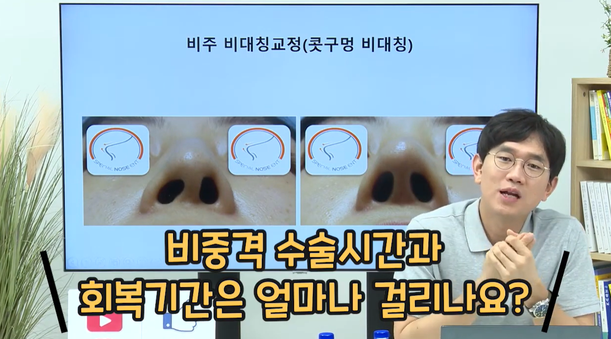 비중격 수술시간, 회복기간