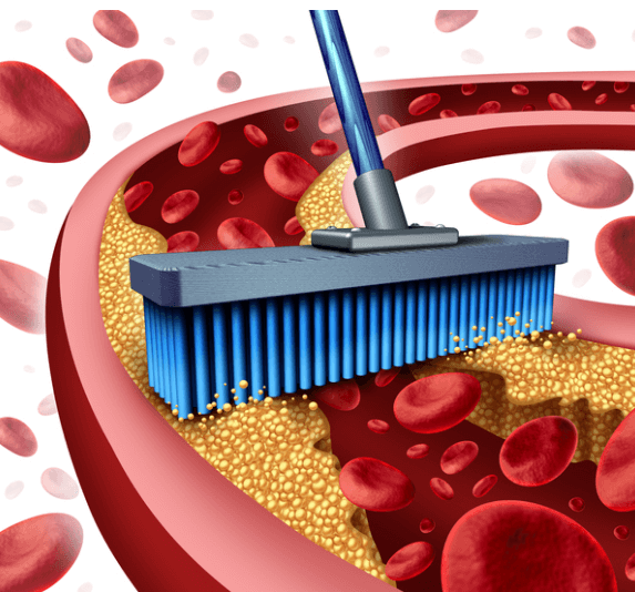 혈전을예방하는혈관청소사진-알파리놀렌산