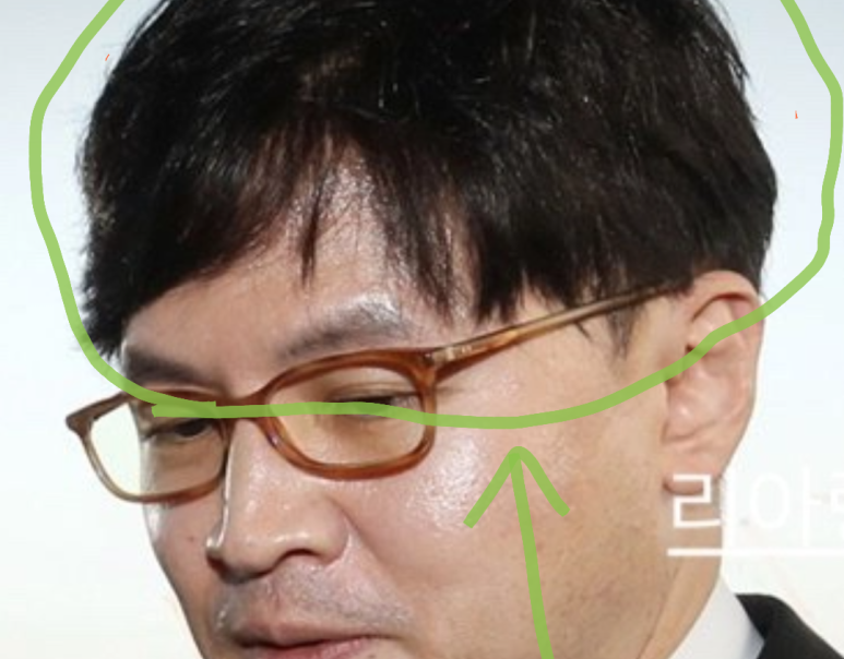 한동훈 대머리