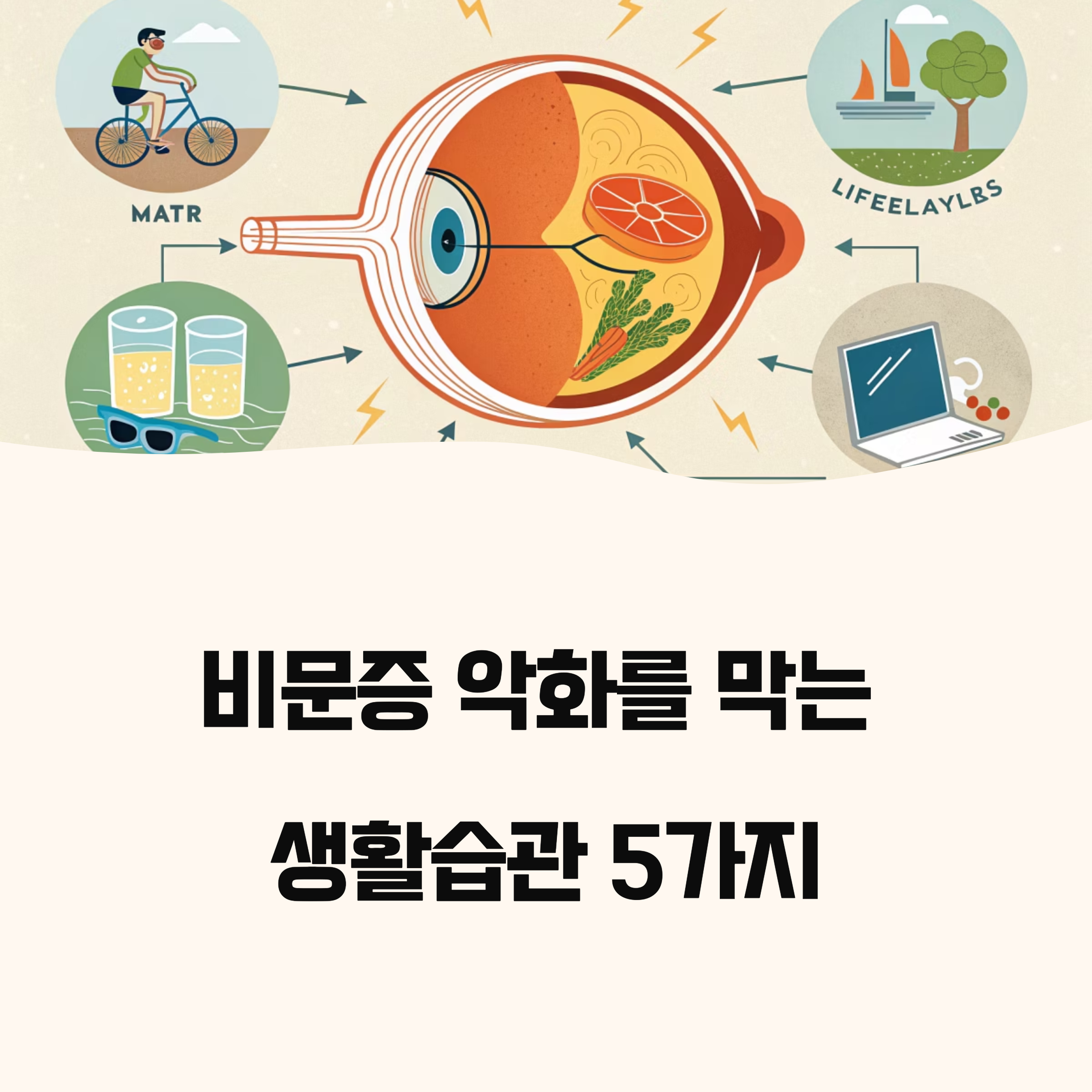 비문증 악화를 막는 생활습관 5가지