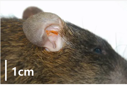 쯔쯔가무시 병의 증상과 치료법(예방법)