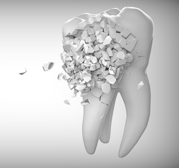 이빨 빠지는 꿈