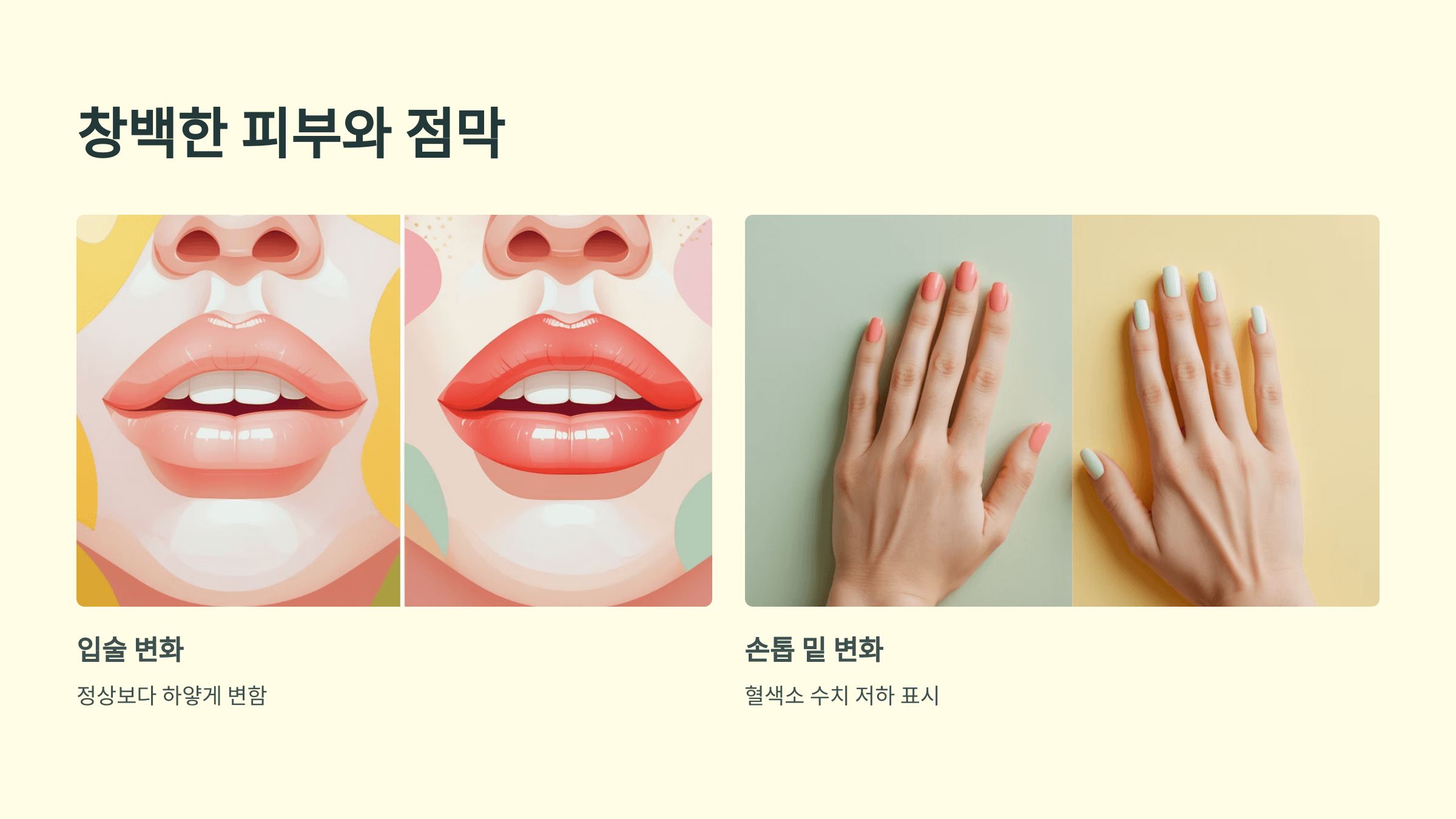 빈혈과 관련된 사진입니다.