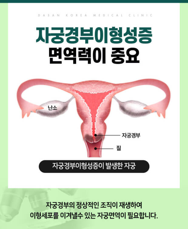 자궁경부이형성증과 면역력